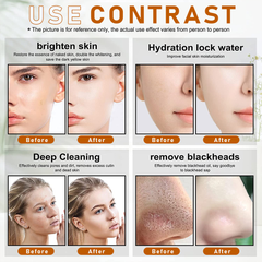 6 In 1 Hydro Dermabrasion Water Facial Skin Care Anti-Aging Skin Care Machine